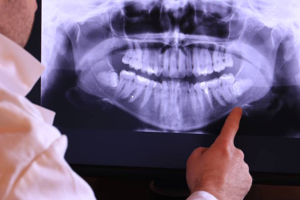 Best Knocked-Out Tooth (Avulsed Tooth) Treatment in Kirby, TX